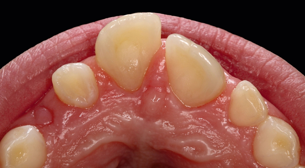 179940-flexible-1900.jpg 179940-flexible-1900.jpg