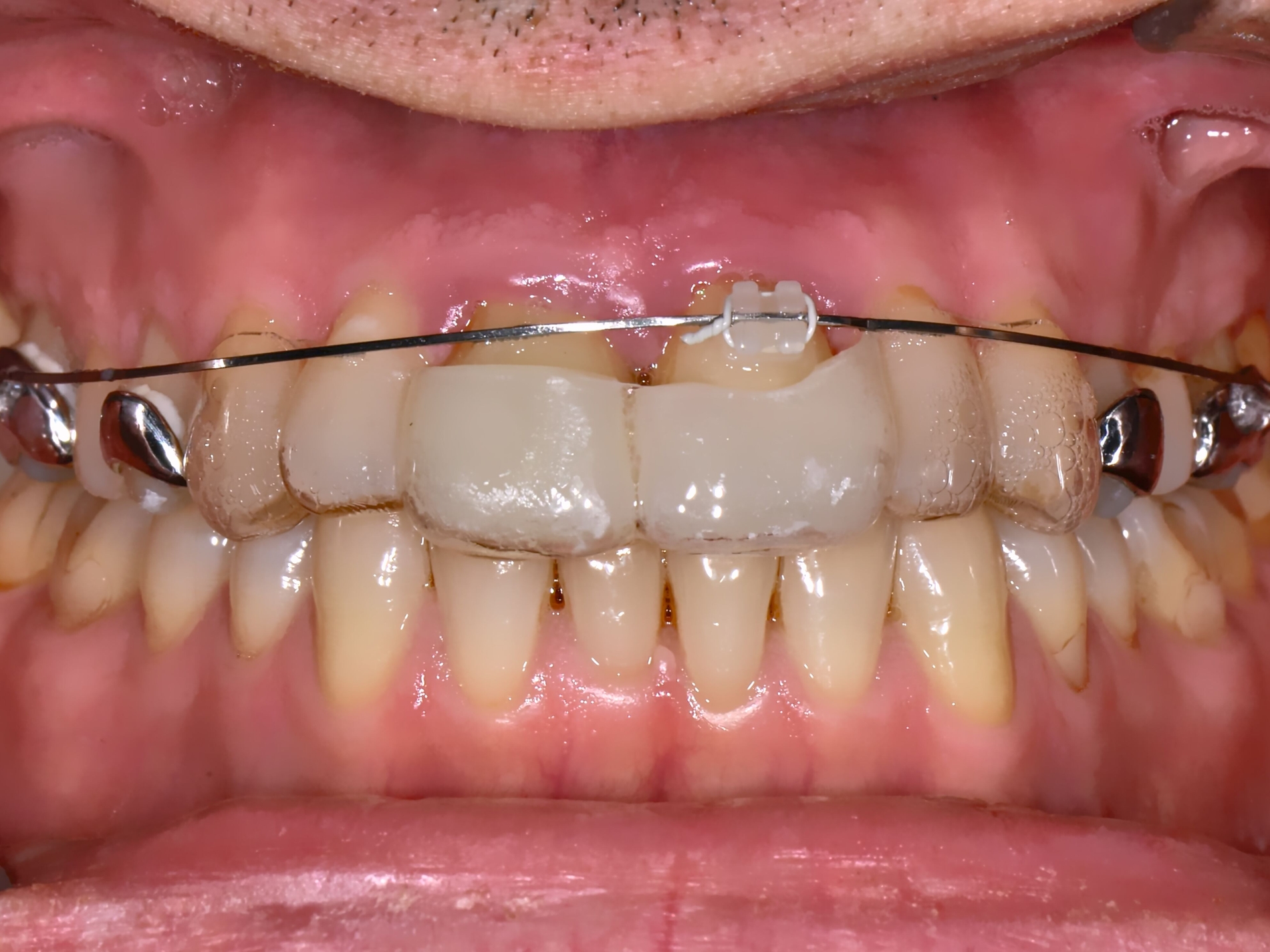 259555-flexible-1900.jpg 259555-flexible-1900.jpg