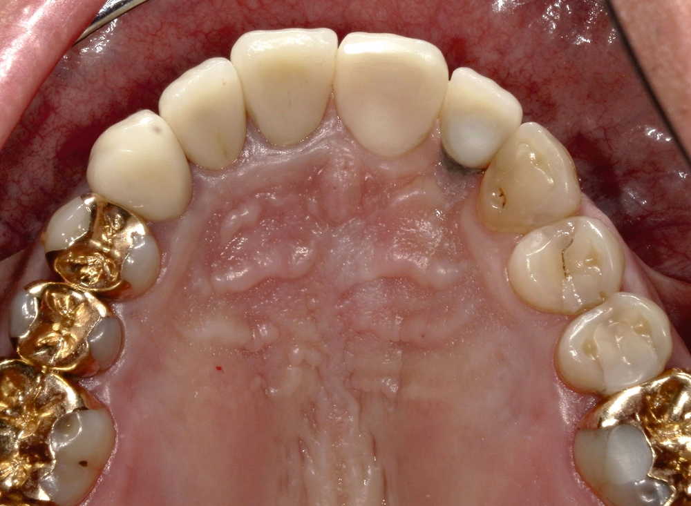177853-flexible-1900.jpg 177853-flexible-1900.jpg