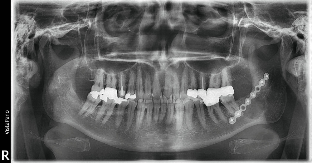 178297-flexible-1900.jpg 178297-flexible-1900.jpg