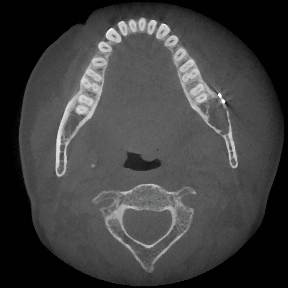 178300-flexible-1900.jpg 178300-flexible-1900.jpg
