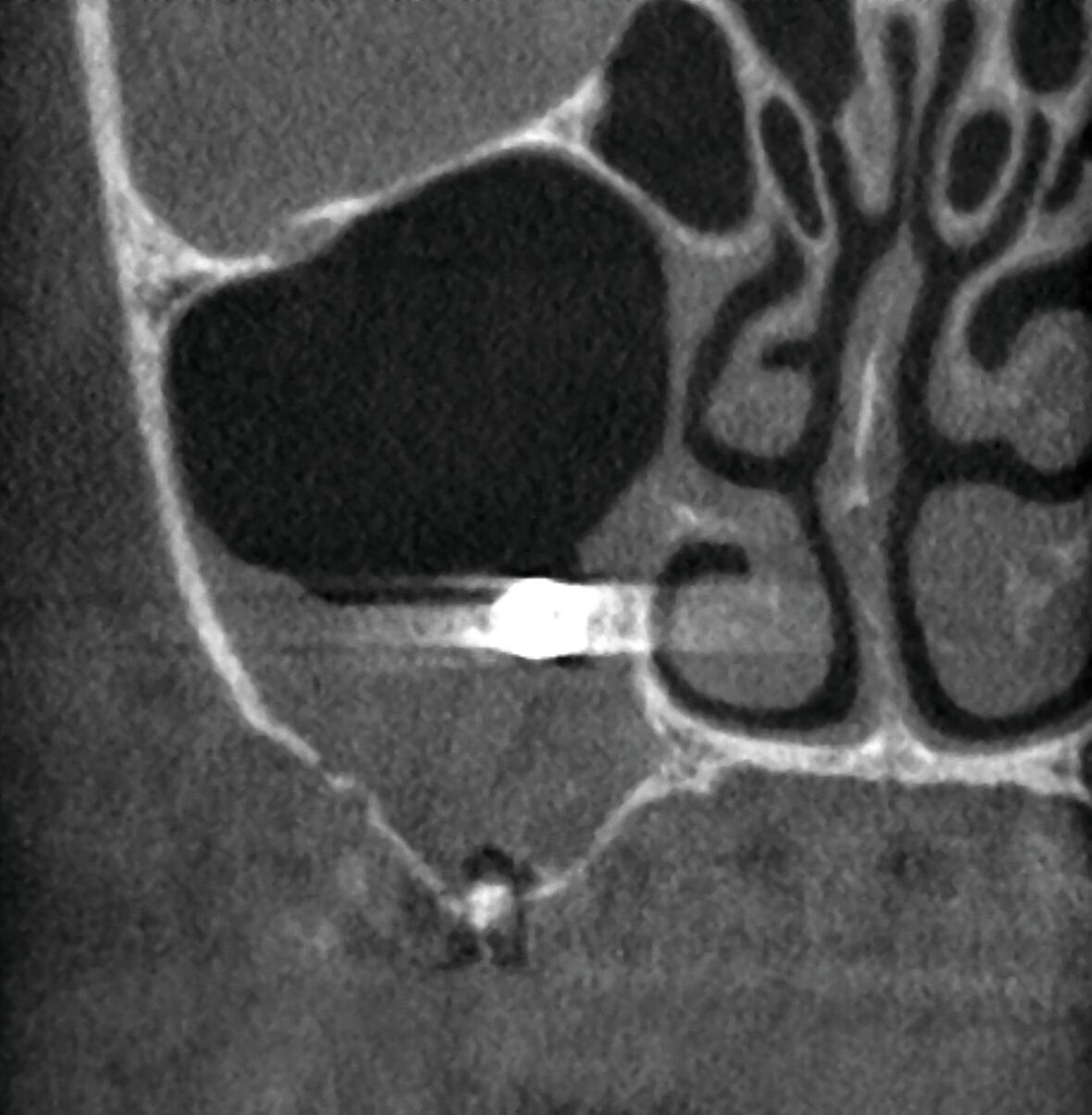 331958-flexible-1900.jpg 331958-flexible-1900.jpg