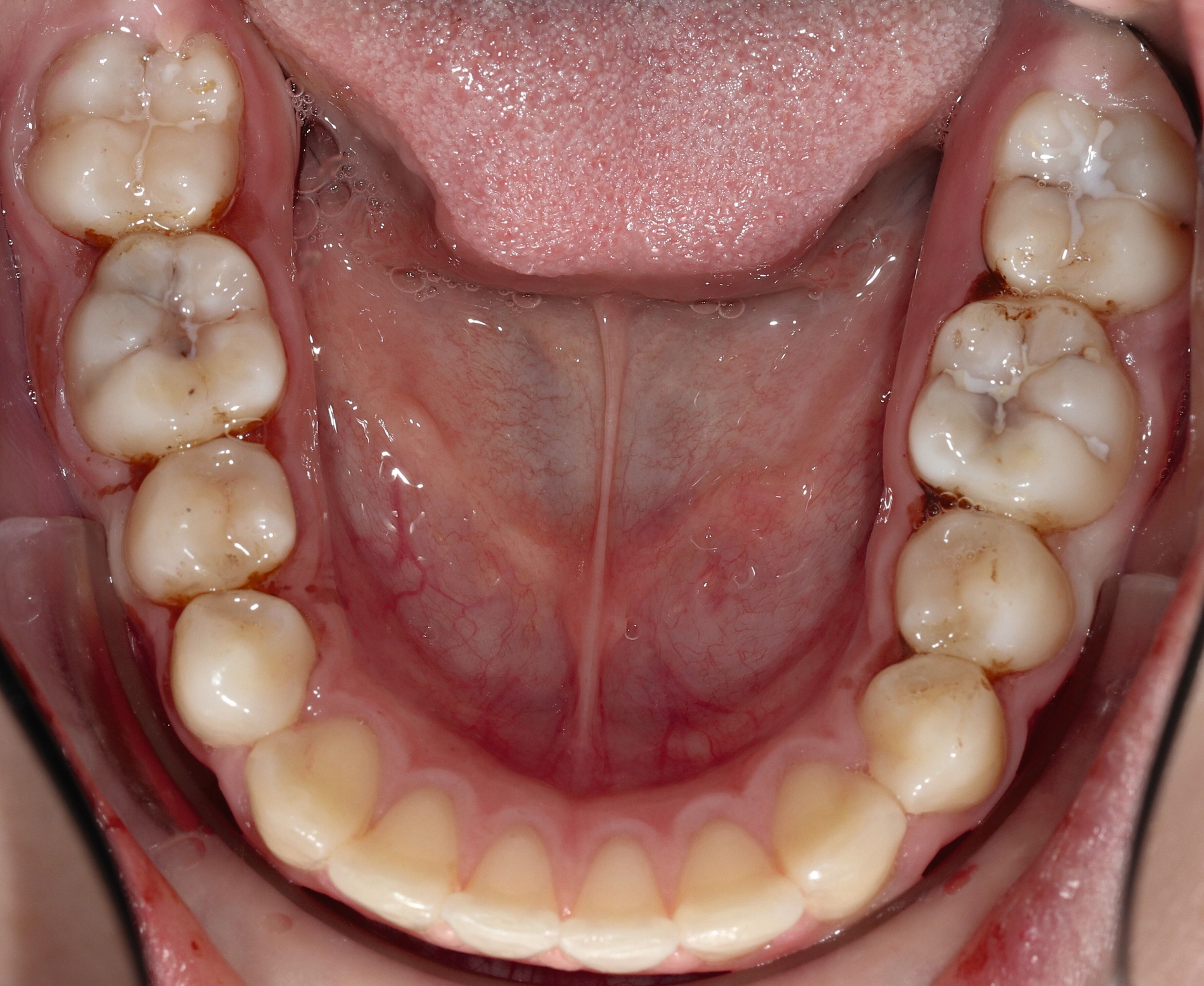 356510-flexible-1900.jpg 356510-flexible-1900.jpg