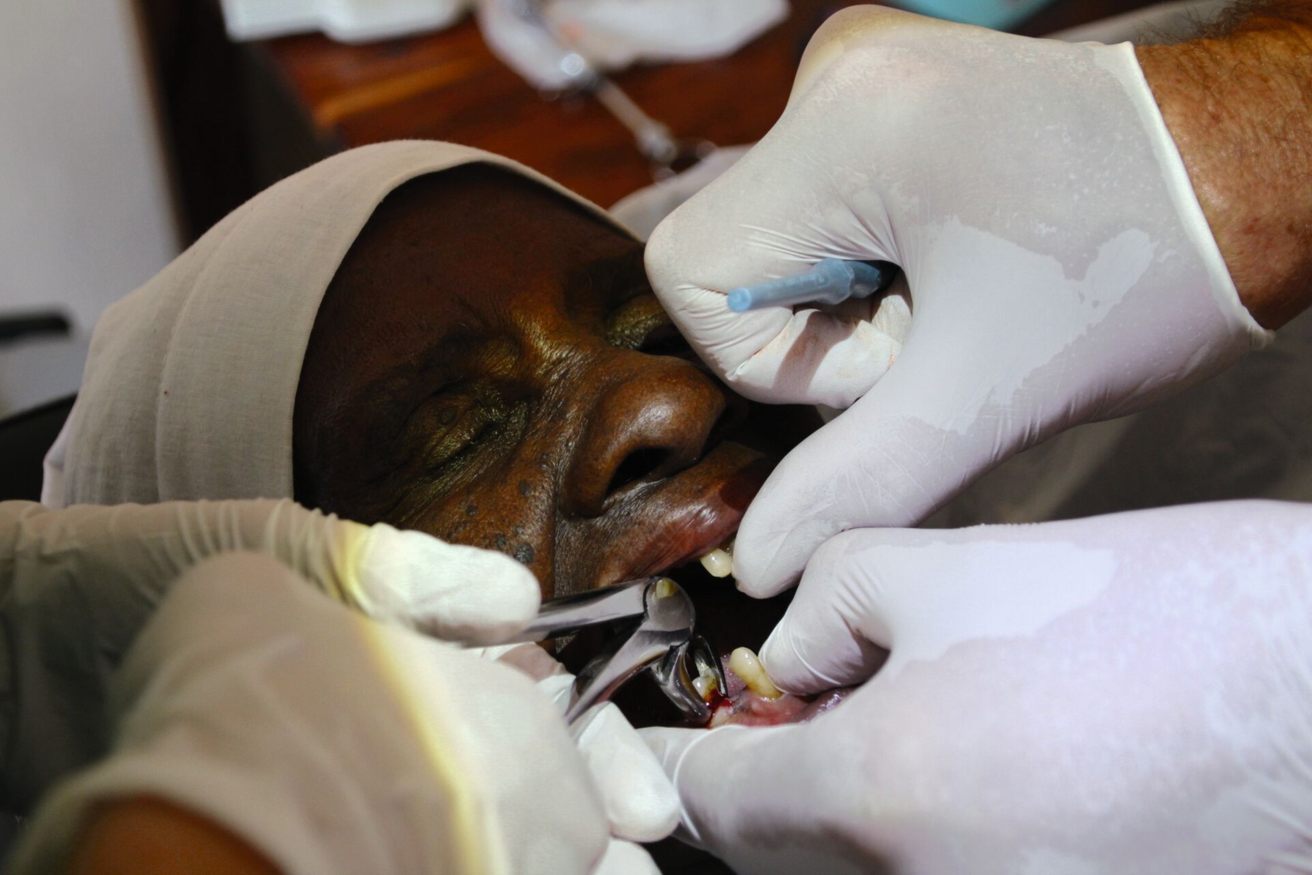 DWLF Tansania Zahnextraktion