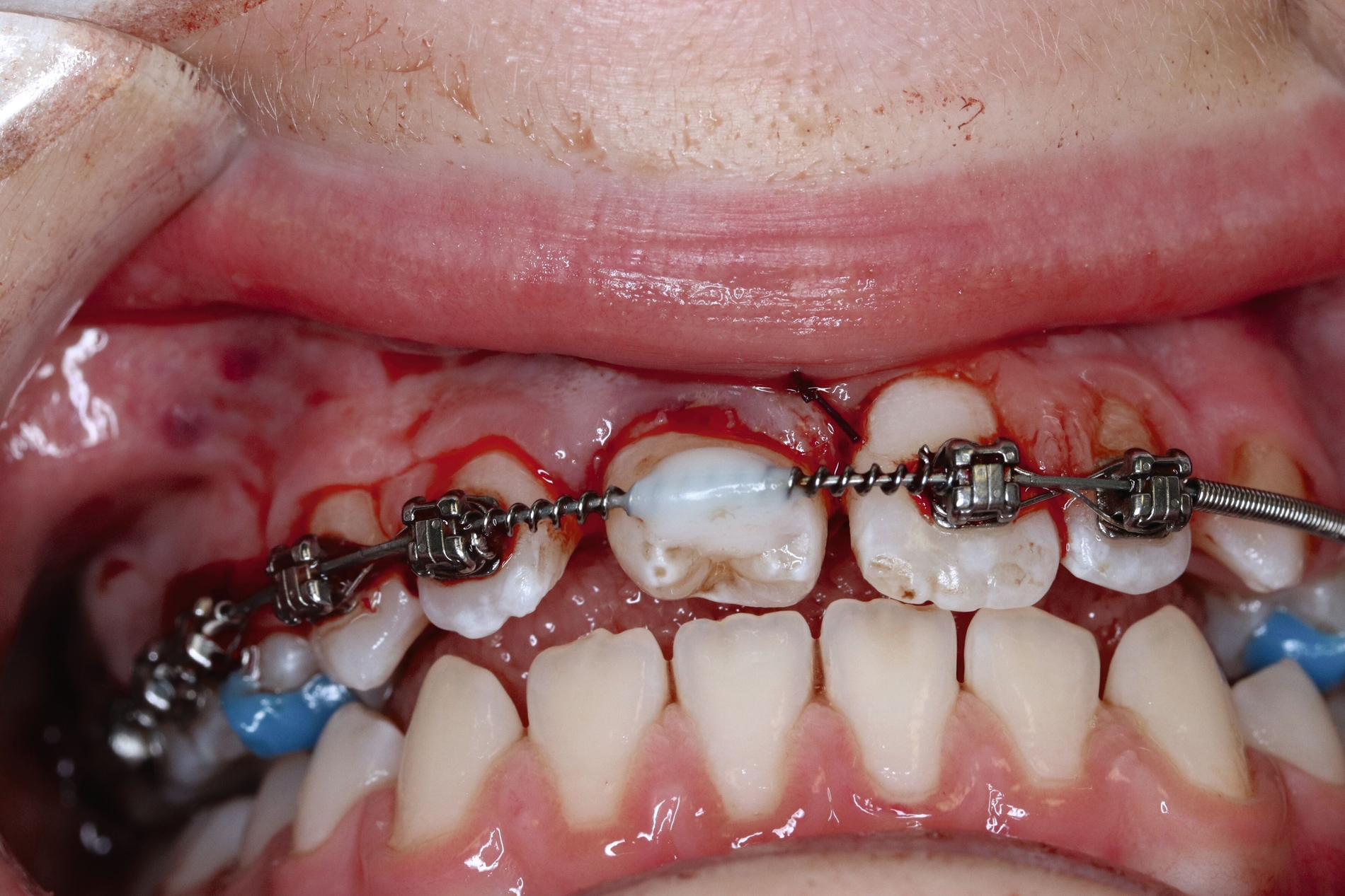 464287-flexible-1900.jpg 464287-flexible-1900.jpg
