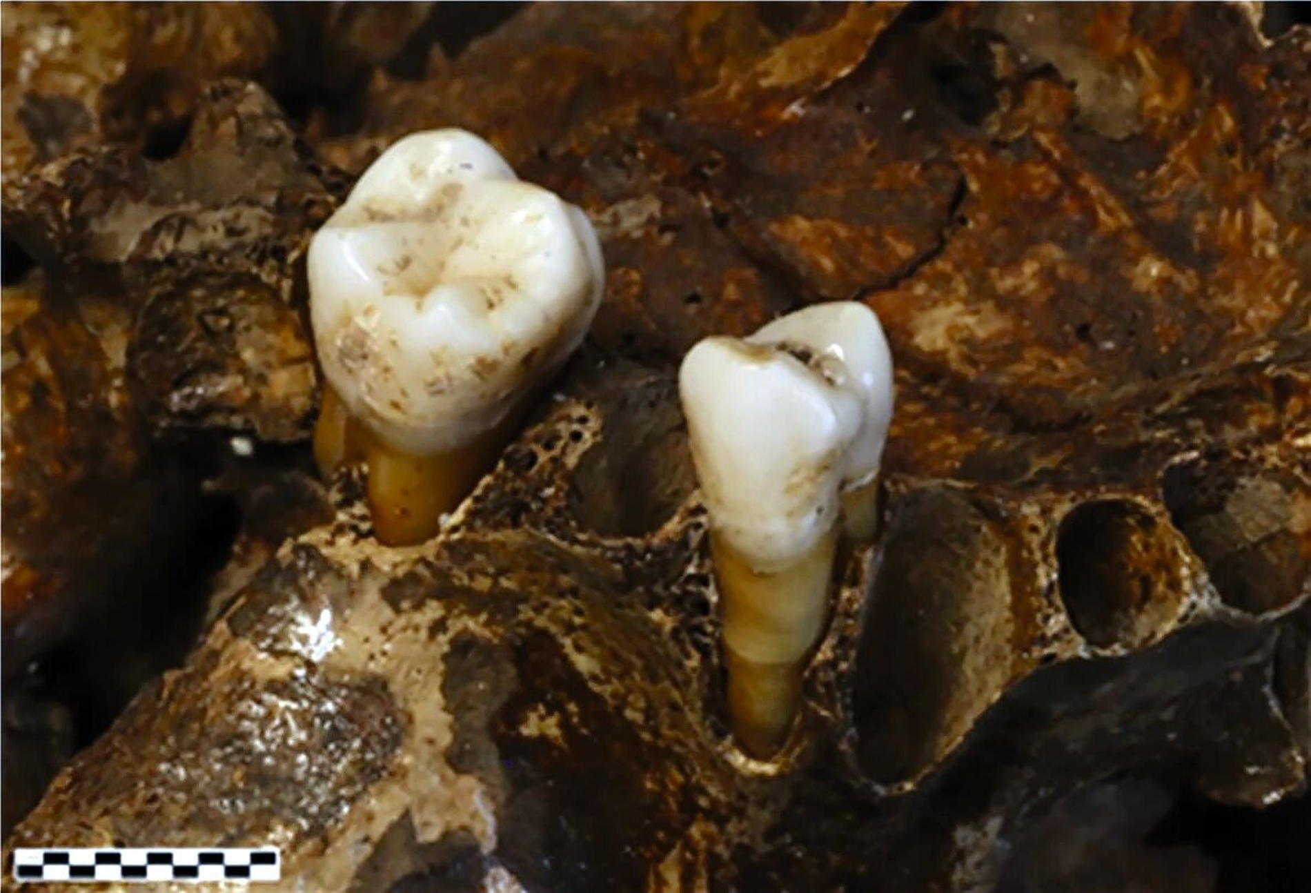 545838-flexible-1900.jpg Bukko-okklusale Ansicht der oberen M 1 und P 3 noch in situ.
