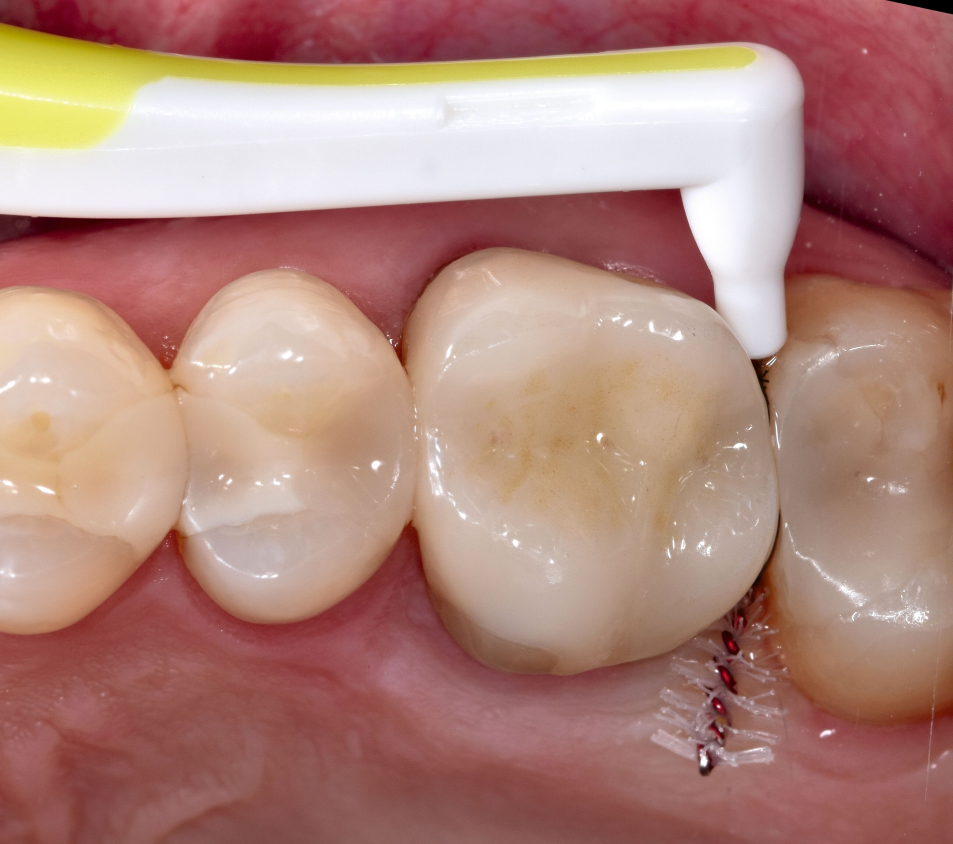 546770-flexible-1900.jpg 546770-flexible-1900.jpg