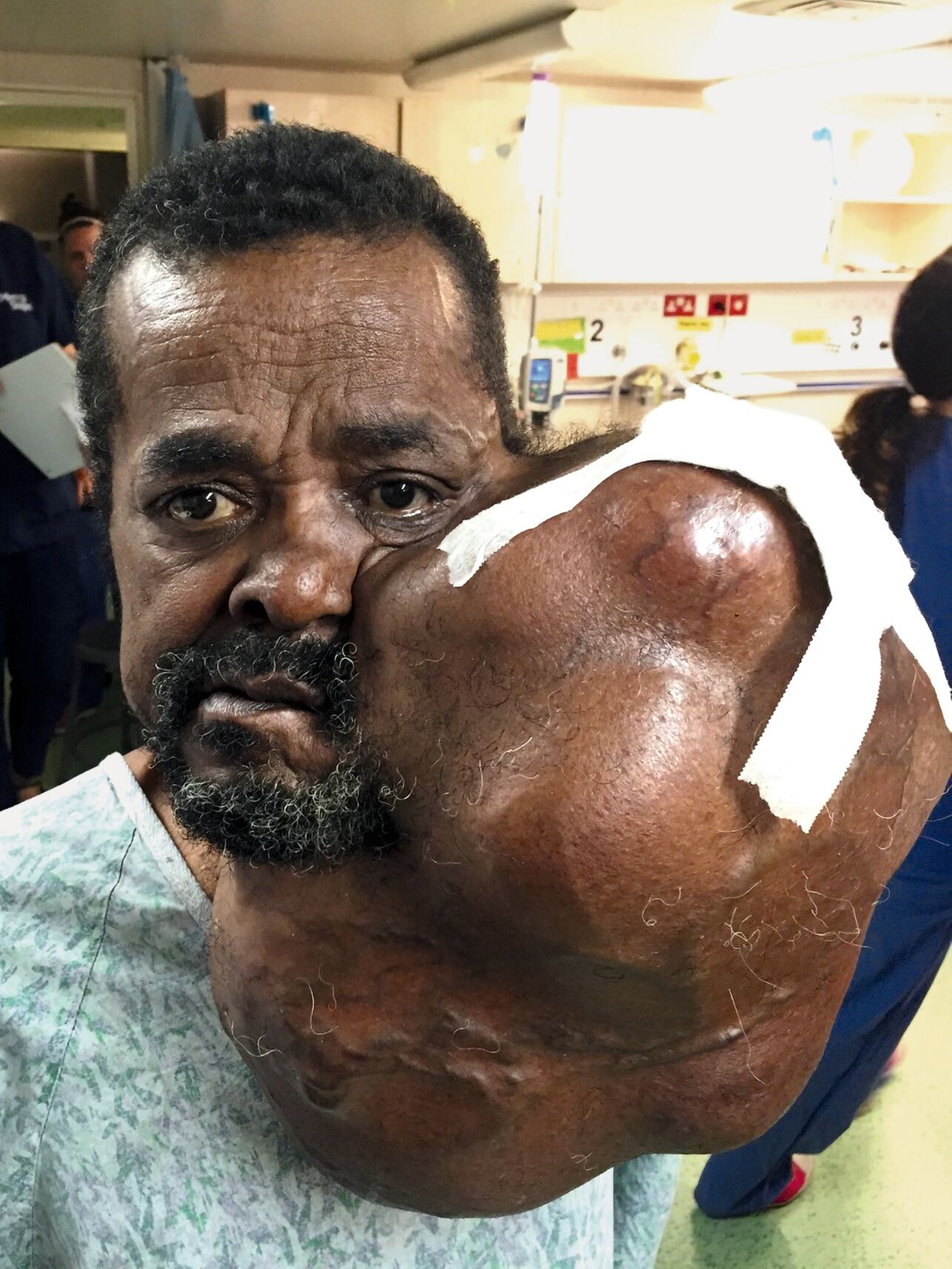 Tumorpatient auf der Africa Mercy vor ...