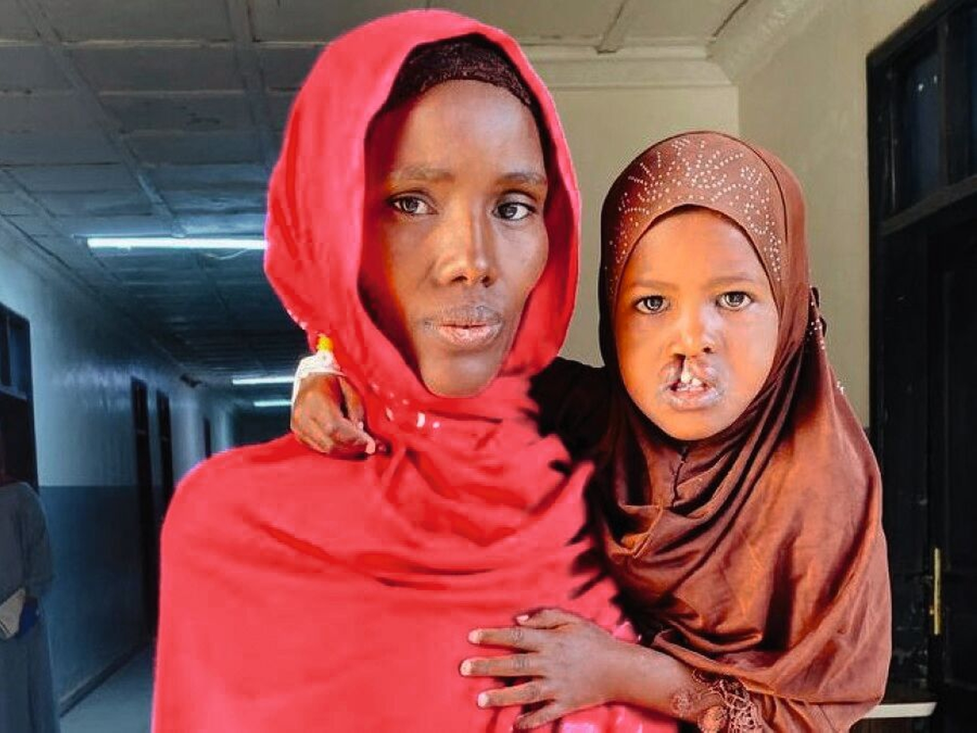 Deutsche Cleft Kinderhilfe: Hilfseinsatz in Äthiopien