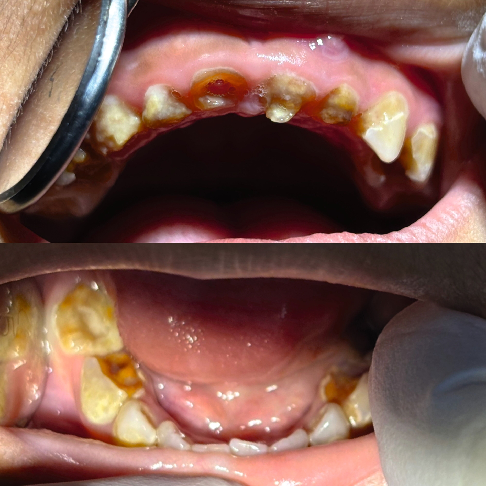 Mini Molars in Kambodscha