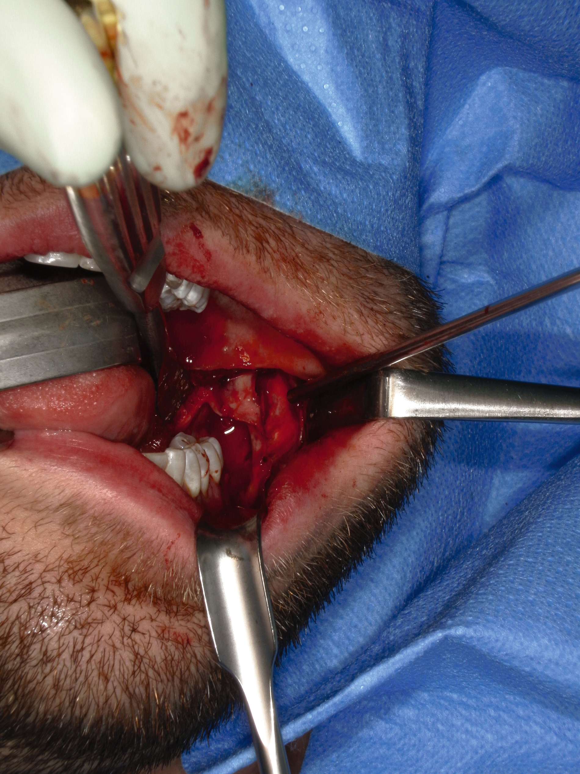 SHOFU DENTAL DIGITAL CAMERA