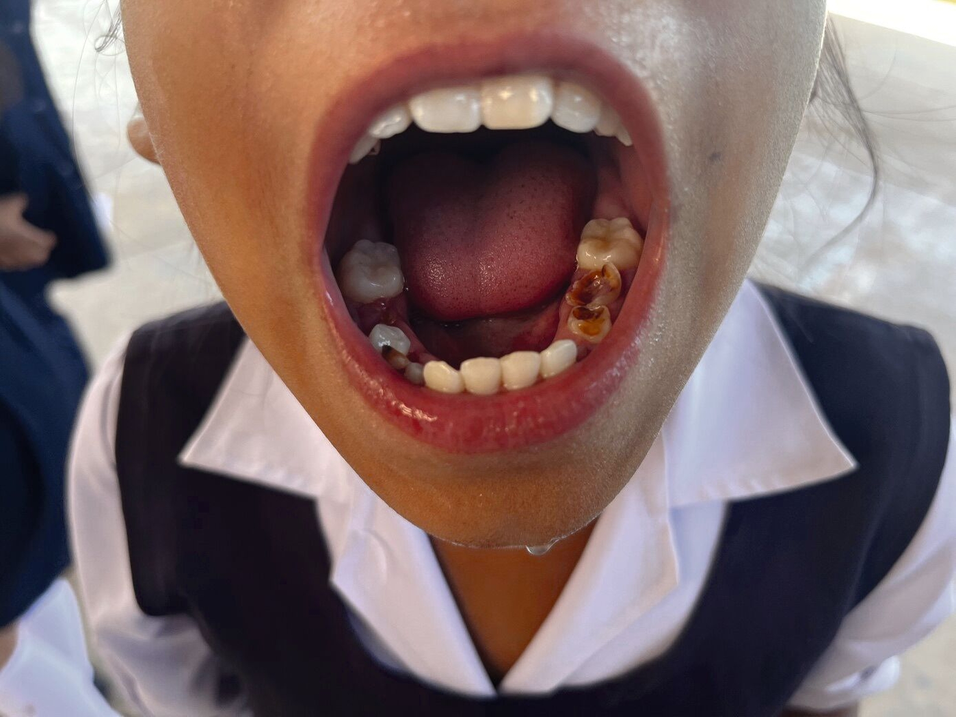 Freiwilligeneinsatz in Huancarani (Bolivien) für den Förderkreis Clinica Santa Maria e.V. (FCSM).