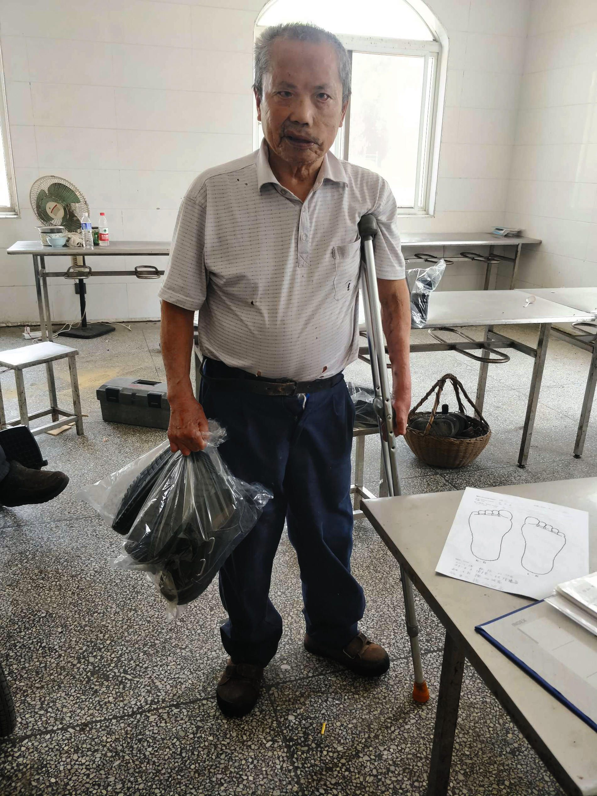 Leprapatient in China mit Prothese.