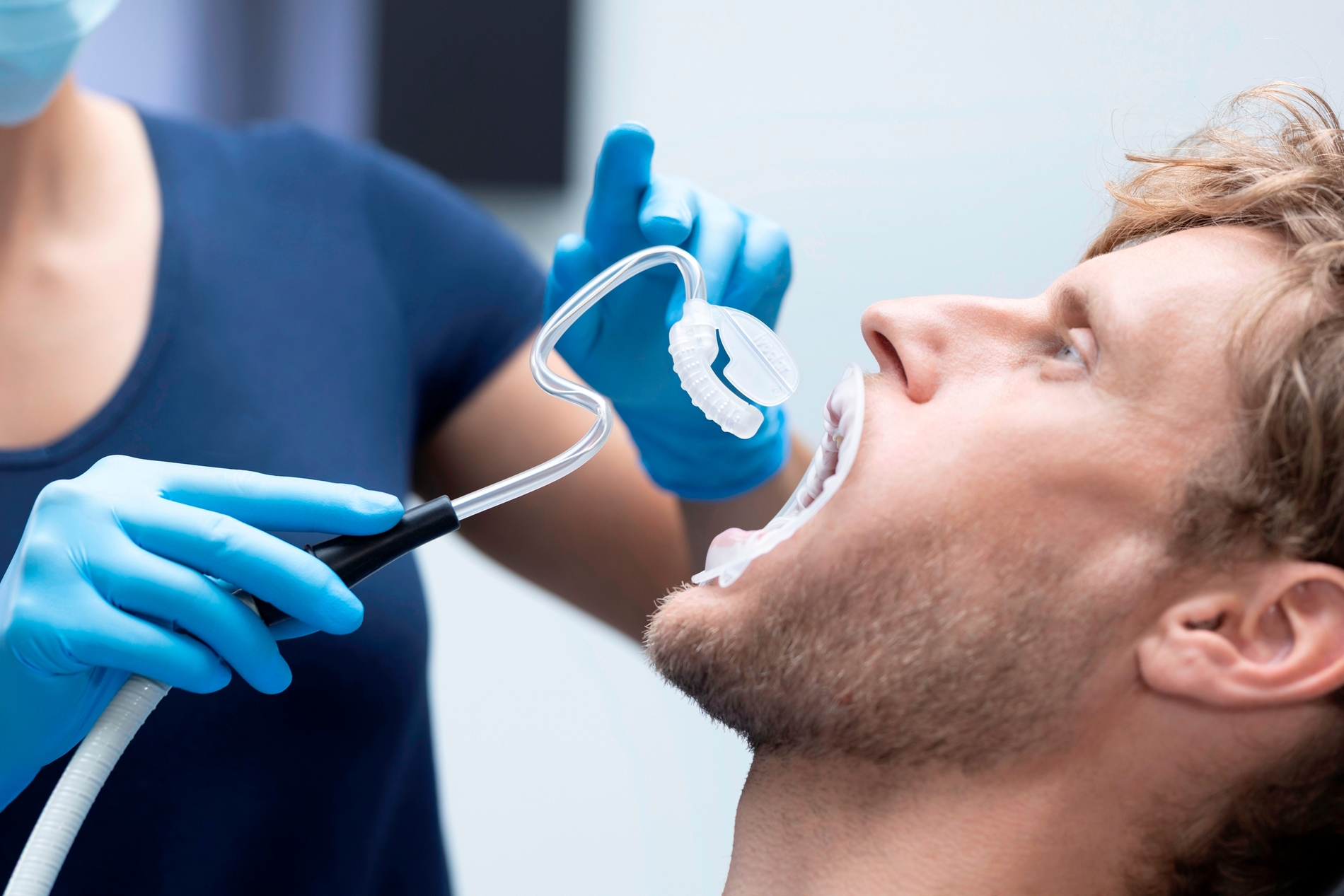 OptraGate Dry Control in Kombination mit OptraGate 2 als ideale Voraussetzung für die relative Trockenlegung.