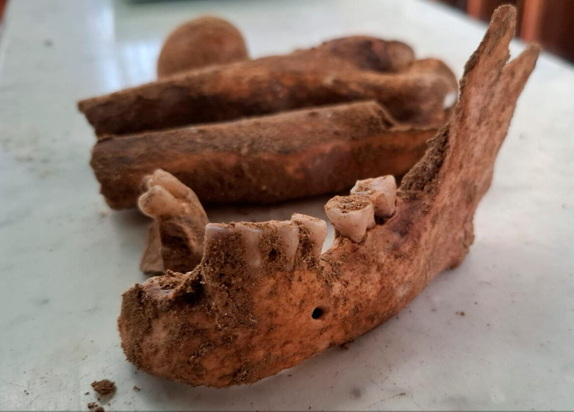 Das sind der Unterkiefer und die Zähne, die im Rahmen des DNA-Tests untersucht werden.