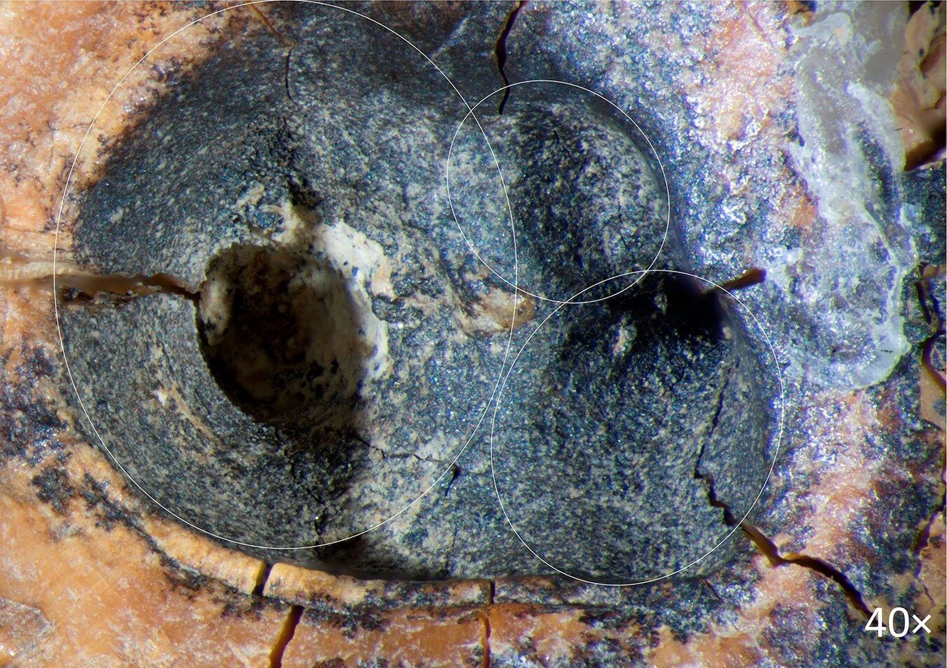 Loch im Zahn eines in Russland gefundenen Neandertalers. Loch im Zahn eines in Russland gefundenen Neandertalers.